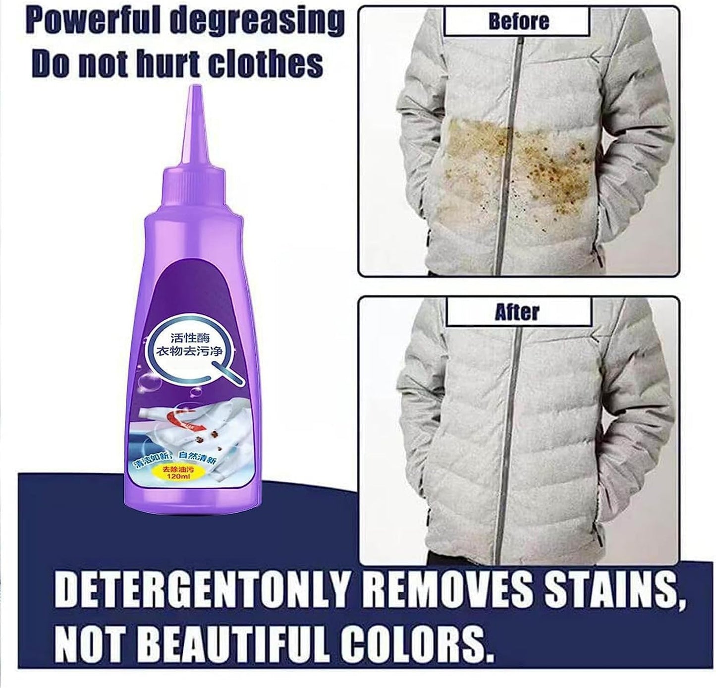 All color Stain Remover for Clothes,Active Enzyme Laundry Stain Remover | Multi-Purpose Roll Bead Fabric Clothes Stain Remover for Cotton, Linen, Polyester, Blended Fabric (120 ML)